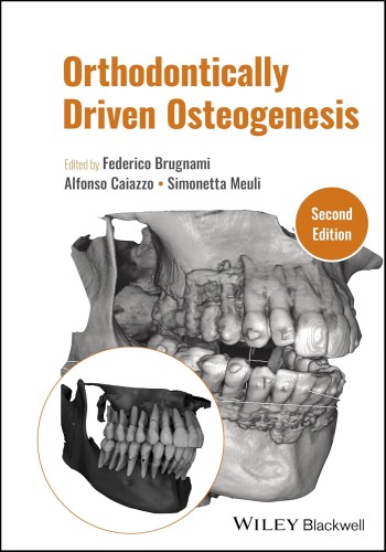 Orthodontically Driven Osteogenesis 2024