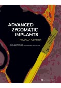 Advanced Zygomatic Implants: The Zaga Concept 2023