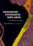 Advanced Zygomatic Implants: The Zaga Concept 2023
