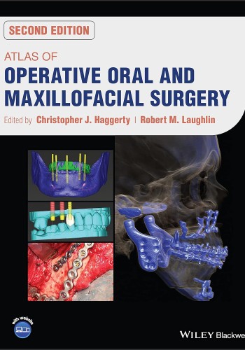Atlas of Operative Oral and Maxillofacial Surgery 2023