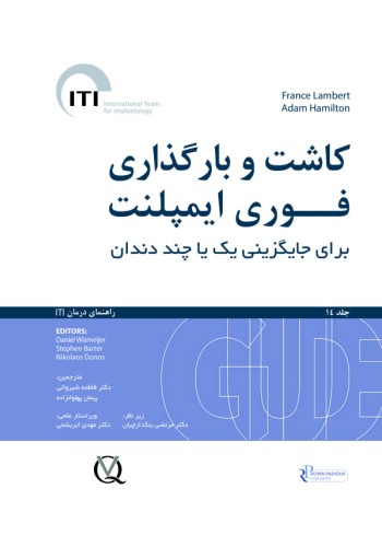 کاشت و بارگذاری فوری ایمپلنت برای جایگزینی یک یا چند دندان جلد ،14 راهنمای درمان ITI