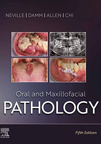 Oral and Maxillofacial Pathology 2023