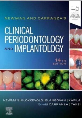 Newman and Carranza's Clinical Periodontology and Implantology 2024