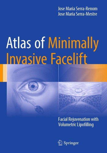 Atlas of Minimally Invasive Facelift 
