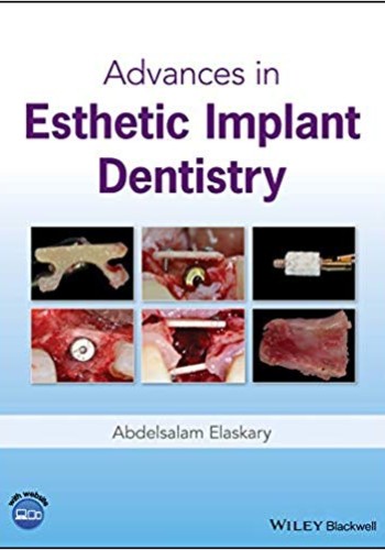 Advances in Esthetic Implant Dentistry 2019