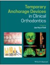 Anchorage Orthodonti.jpg