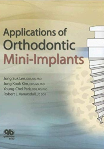Applications of Orthodontic Mini-Implants2007