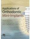 Applications of Orthodontic Mini-Implants.jpg