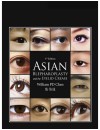 Asian Blepharoplasty and the Eyelid Crease (2016).jpg