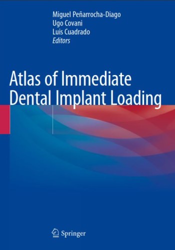 Atlas of Immediate Dental Implant Loading 2019
