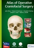 Atlas of Operative Craniofacial Surgery 2019
