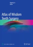 Atlas of Wisdom Teeth Surgery 2019