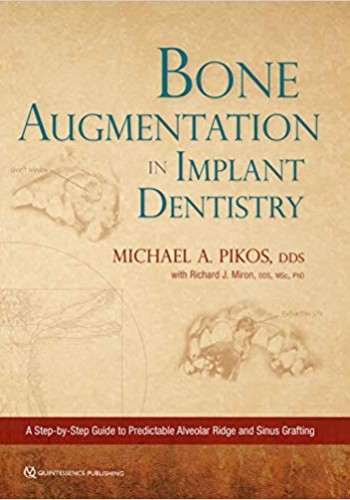 Bone Augmentation in Implant Dentistry 2019