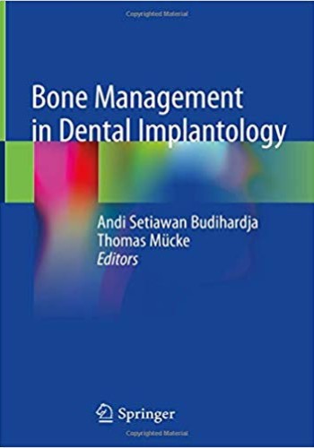 Bone Management in Dental Implantology 2019