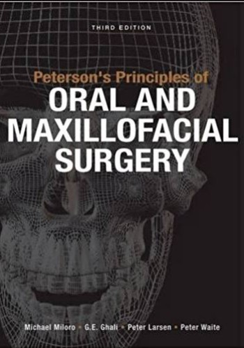 Peterson's Principles of Oral and Maxillofacial Surgery 2011