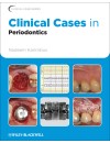 Clinical Cases in Periodontics.jpg