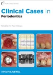 Clinical Cases in Periodontics 2012