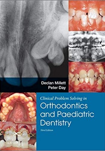 Clinical Problem Solving in Orthodontics and Paediatric Dentistry2017