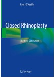 Closed Rhinoplasty2019