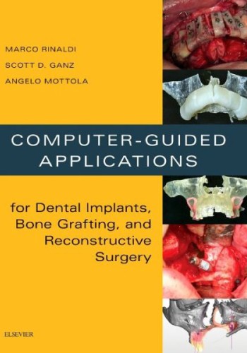Computer-Guided Applications for Dental Implants, Bone Grafting, and Reconstructive Surgery 2016