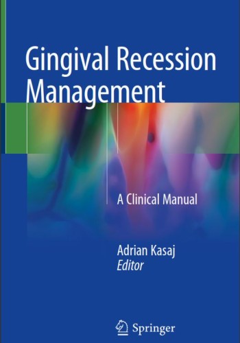 Gingival Recession Management2018