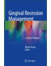 Gingival Recession Management.JPG