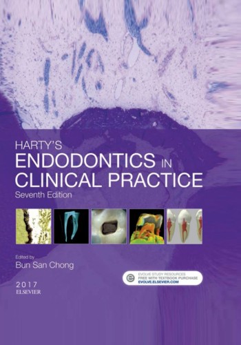 Hartys Endodontics in Clinical Practice2017