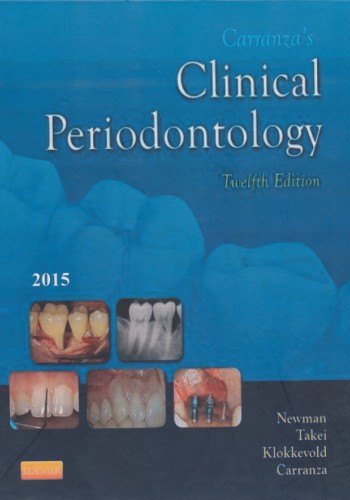 Carranza's Clinical Periodontology - Vol 1&2