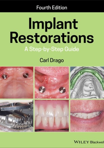 Implant Restorations2020