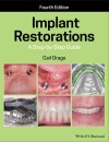 Implant Restorations.JPG