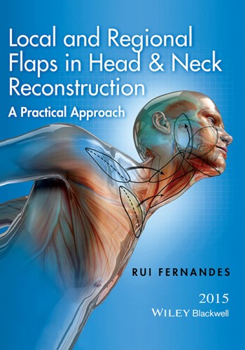 Local and Regional Flaps in Head and Neck Reconstruction 2015