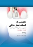 بازاریابی در ایمپلنت های دندانی چگونگی ترغیب بیماران برای انجام درمان های ایمپلنت