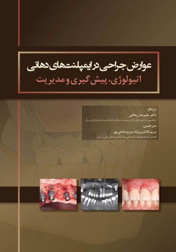عوارض جراحی در ایمپلنت های دهانی اتیولوژی، پیشگیری و مدیریت
