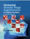 Pages from 159-RP-Horizontal Alveolar Ridge Augmentation in Implant Dentistry (2016).jpg