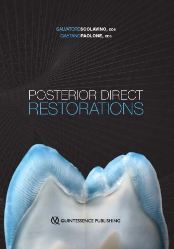 2021 Posterior Direct Restorations