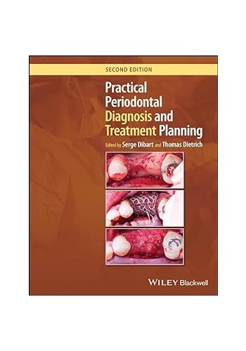 Practical Periodontal Diagnosis and Treatment Planning 2024