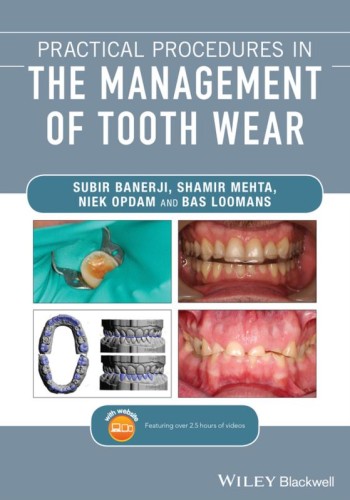 Practical Procedures in the Management of Tooth Wear2020 