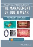 Practical Procedures in the Management of Tooth Wear2020 