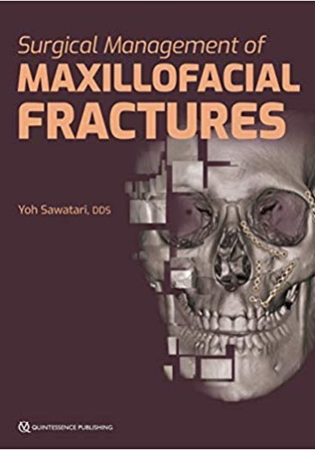 Surgical Management of Maxillofacial Fractures 2019