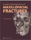 Surgical Management of Maxillofacial Fractures.jpg
