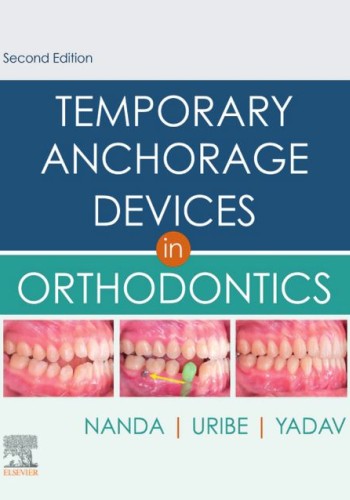 Temporary Anchorage Devices in Orthodontics2021