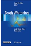 Tooth Whitening 2016