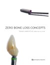 Zero Bone Loss Concepts (2019).jpg