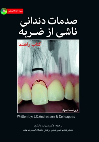 صدمات دندانی ناشی از ضربه