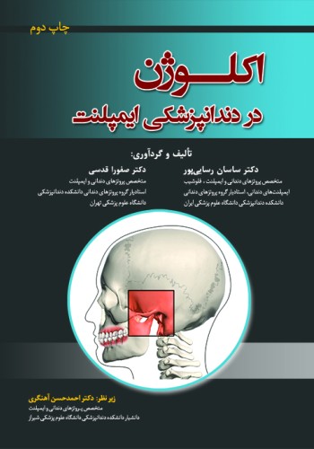 اکلوژن در دندانپزشکی ایمپلنت