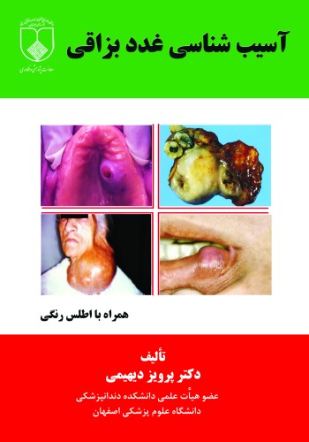 آسیب شناسی غدد بزاقی