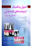 اصول و تکنیک ایمپلنت های تک دندانی (جراحی و پروتز)