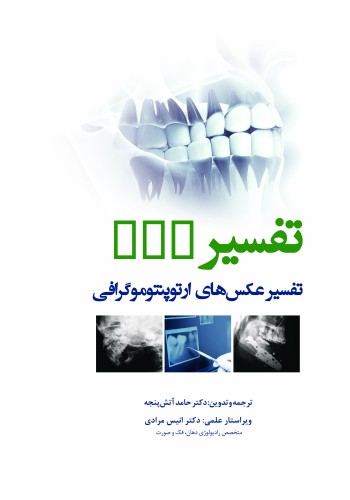 تفسیر OPG  تفسیر عکس‌های ارتوپنتوموگرافی 