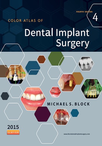 Color Atlas of Dental Implant Surgery 2015