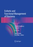 Esthetic and Functional Management of Diastema